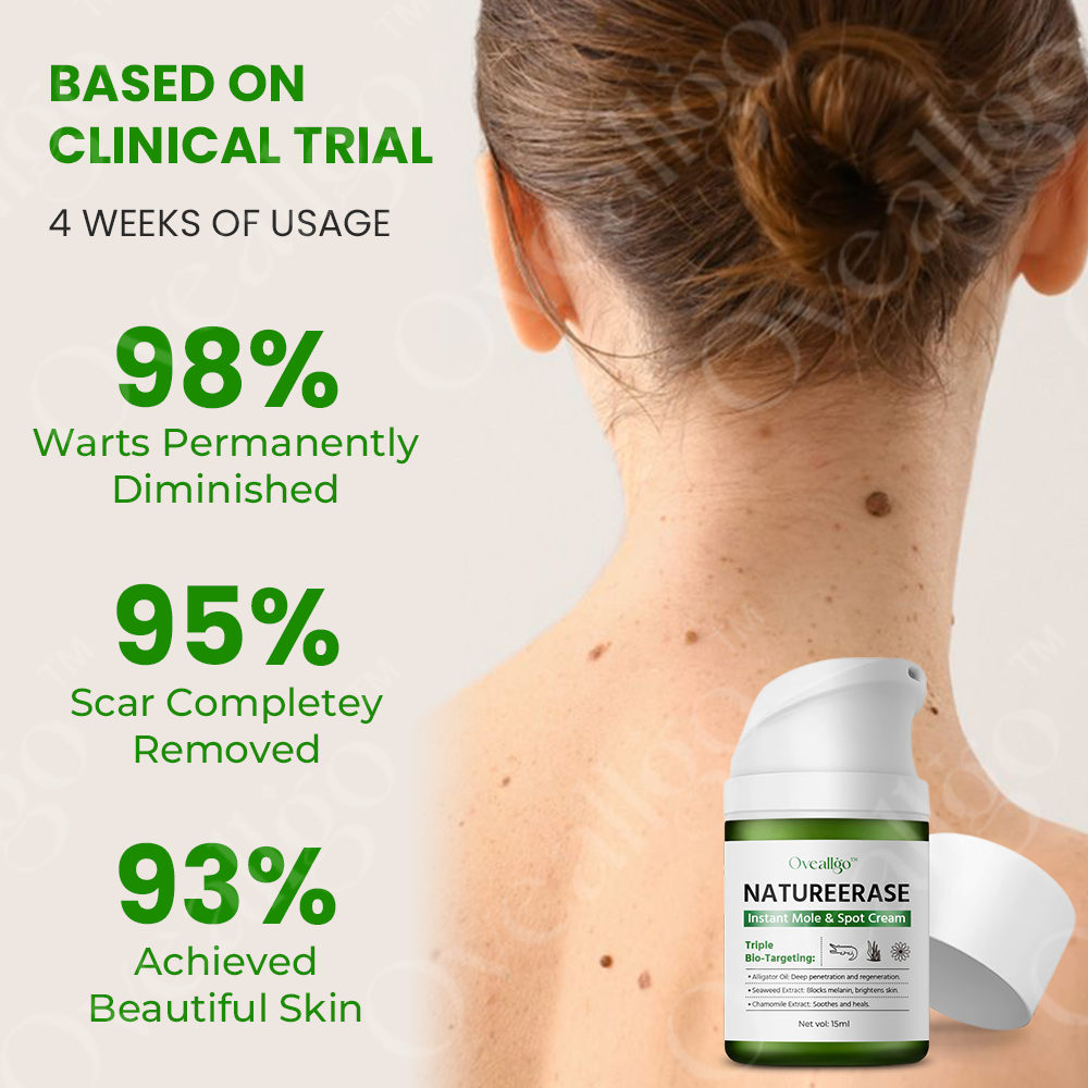 ✅ Official Store: Oveallgo™ NatureErase Pro Instant Mole & Spot Cream