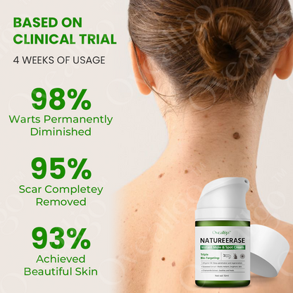 ✅ Official Store: Oveallgo™ NatureErase Pro Instant Mole & Spot Cream