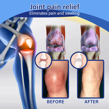 ✅💡 Official Store: NEGUSY™ Lidocaine Joint Pain Relief and Healing Solution 👨‍⚕️ Approved by the American Orthopedic Association (AOA) - Alleviates Joint Pain, Swelling, Stiffness, Redness, Heat, Discomfort, and Joint Fatigue
