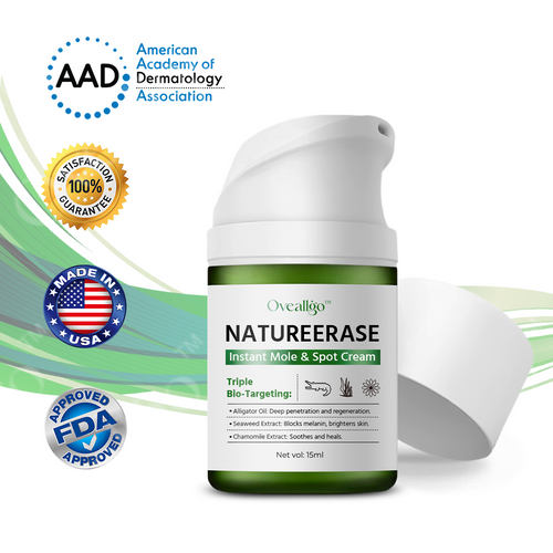 ✅ Official Store: Oveallgo™ NatureErase Pro Instant Mole & Spot Cream