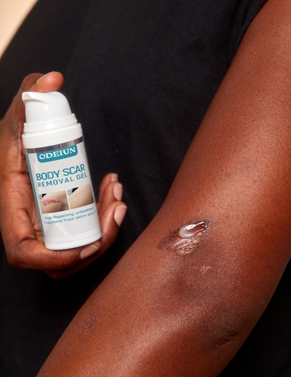 ODEIUN™ SCAR SOLUTIONS SILICONE SCAR GEL