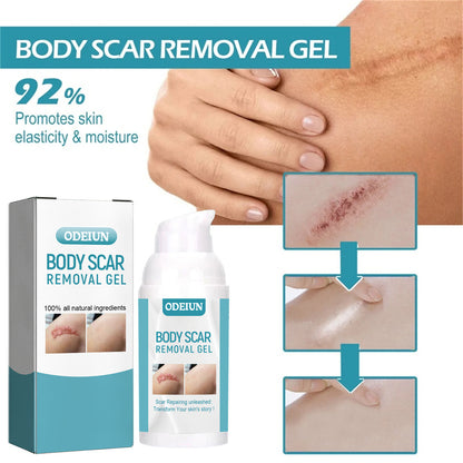 ODEIUN™ SCAR SOLUTIONS SILICONE SCAR GEL