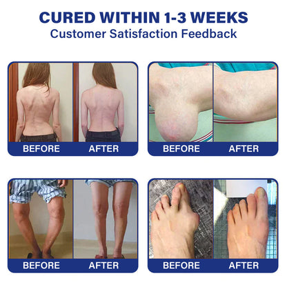 ✅💡 Official Store: NEGUSY™ Lidocaine Joint Pain Relief and Healing Solution 👨‍⚕️ Approved by the American Orthopedic Association (AOA) - Alleviates Joint Pain, Swelling, Stiffness, Redness, Heat, Discomfort, and Joint Fatigue