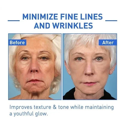 🔥Last Day Promotion 70% OFF🔥-Botox Face Serum