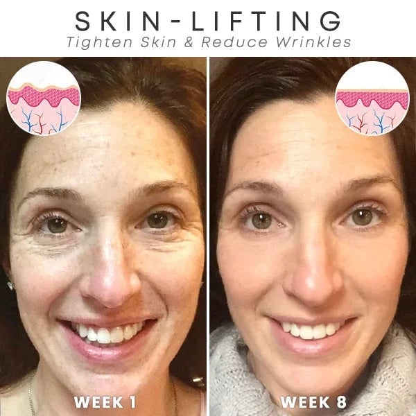 🔥Last Day Promotion 70% OFF🔥-Botox Face Serum