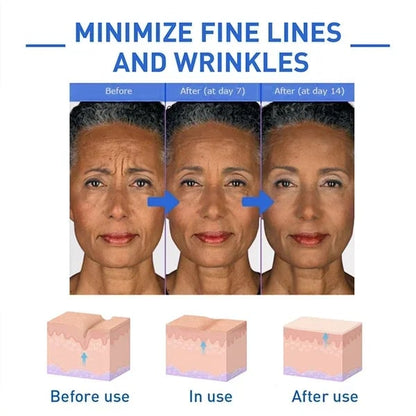 🔥Last Day Promotion 70% OFF🔥-Botox Face Serum