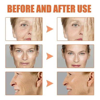 🔥Last Day Promotion 70% OFF🔥-Botox Face Serum