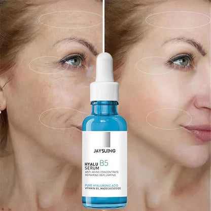 🔥Last Day Promotion 70% OFF🔥-Botox Face Serum