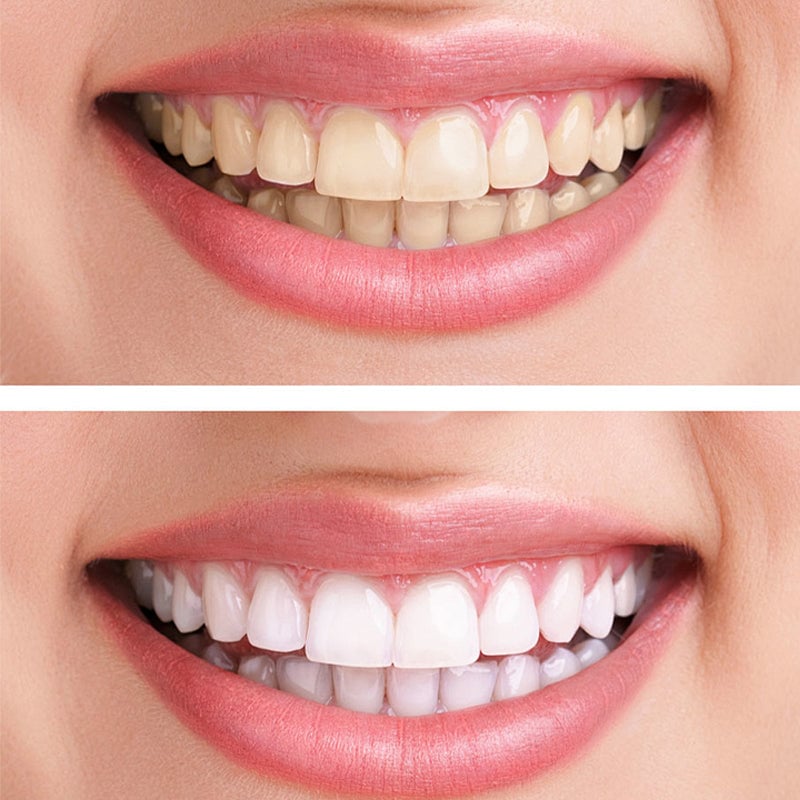 Hydroxyapatite Toothpaste🦷(FDA recommended) (🎁Flash Sale - Don’t Miss Out)