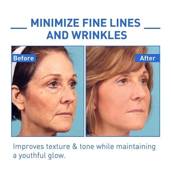 🔥Last Day Promotion 70% OFF🔥-Botox Face Serum