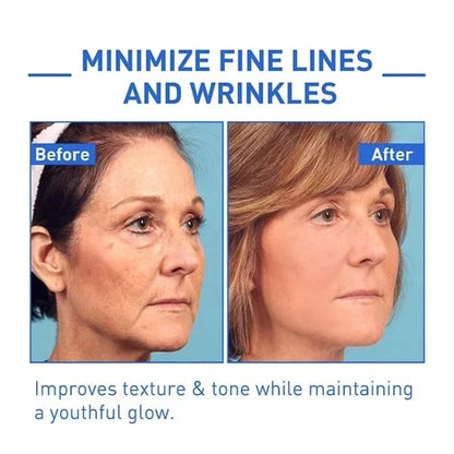 🔥Last Day Promotion 70% OFF🔥-Botox Face Serum